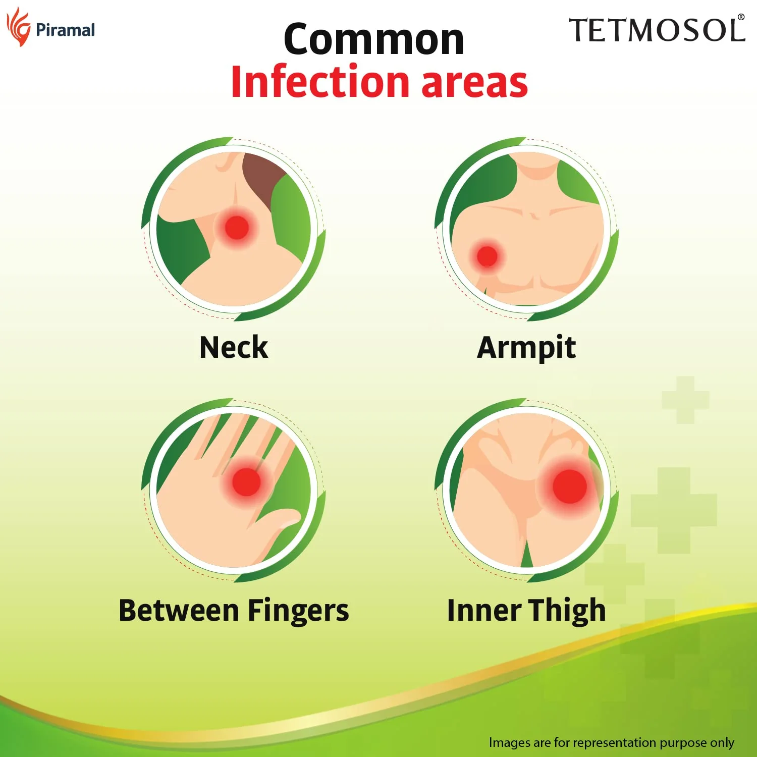Tetmosol Plus Cream | Fights Skin Infections & Relieves Itching -10gm - Image 7